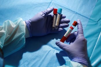 Informe Epidemiológico: Las 10 comunas con más casos activos de coronavirus en Chile