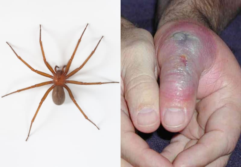 Se acerca el calor y con él la época de reproducción de estas arañas. Es fundamental que aprendas a reconocerla y los síntomas que provoca para actuar de forma oportuna. | Foto: Ariel Cabrera Foix - inaturalist.com