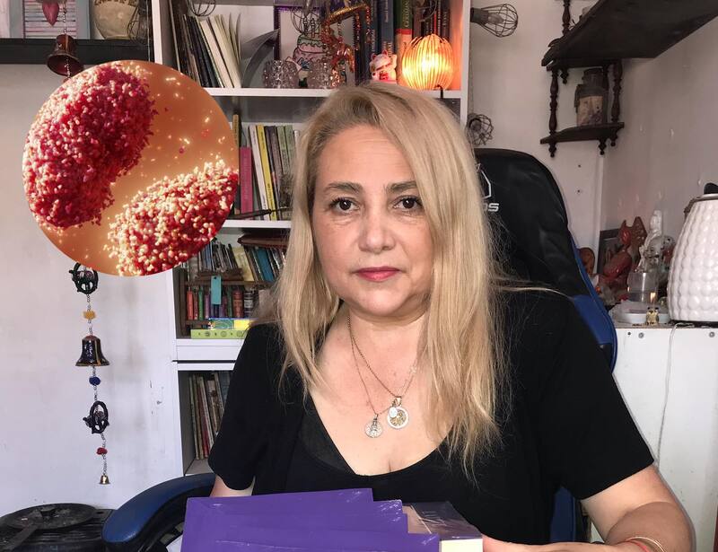 dice que la Viruela del Mono impactará fuertemente en Europa, con cuarentena incluida