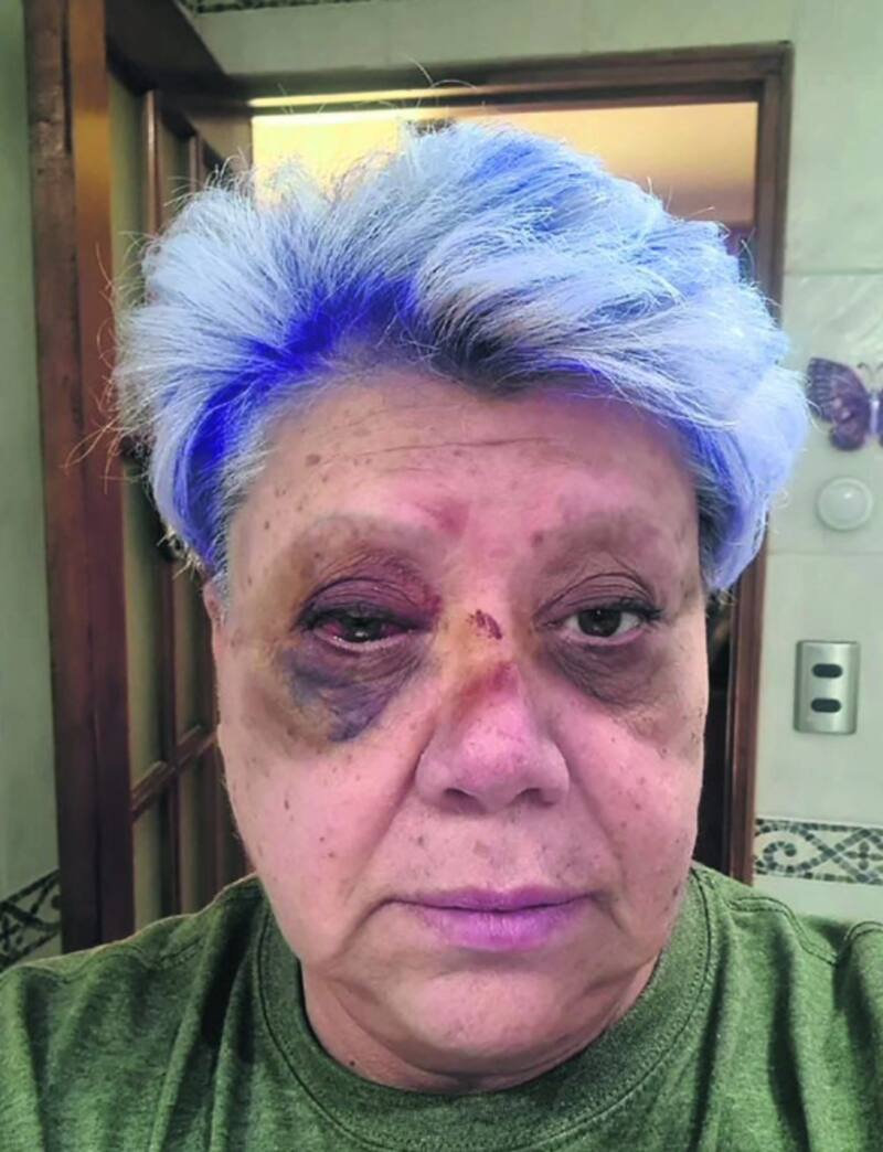 Paty Maldonado después de su accidente automovilístico