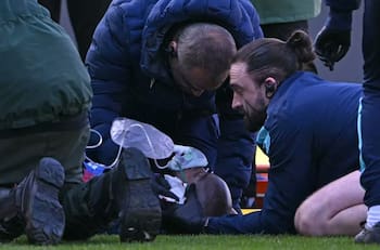 ¡Terminó con oxígeno! La brutal patada en la cara que se vio en la FA Cup