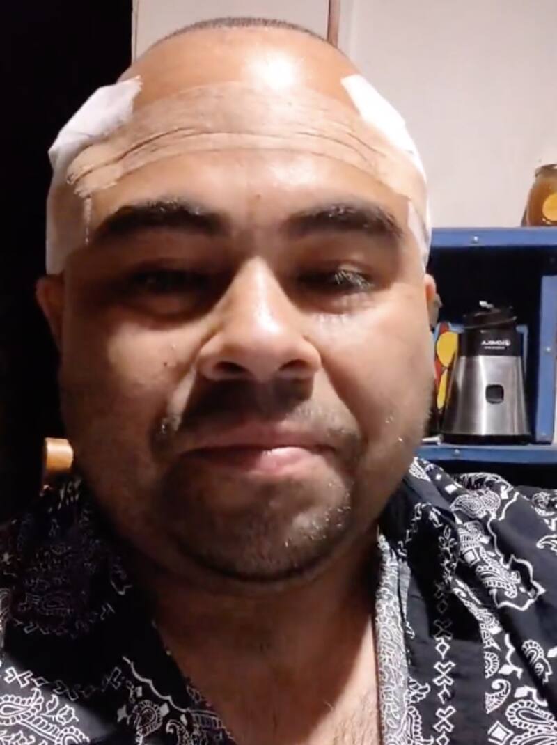 Juan Pablo Álvarez con su tratamiento capilar.