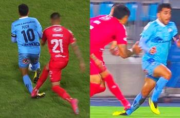 Sufre Deportes Iquique: así quedó el tobillo de Edson Puch tras criminal infracción