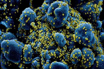 Creado por científicos chilenos: Anticuerpo de alpaca contra el Covid 19 logró uso investigativo