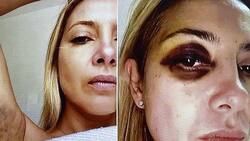 FOTOS | “Tengo moretones”: Filtran nuevos chats de Fabiola Yáñez en medio de denuncia contra Alberto Fernández