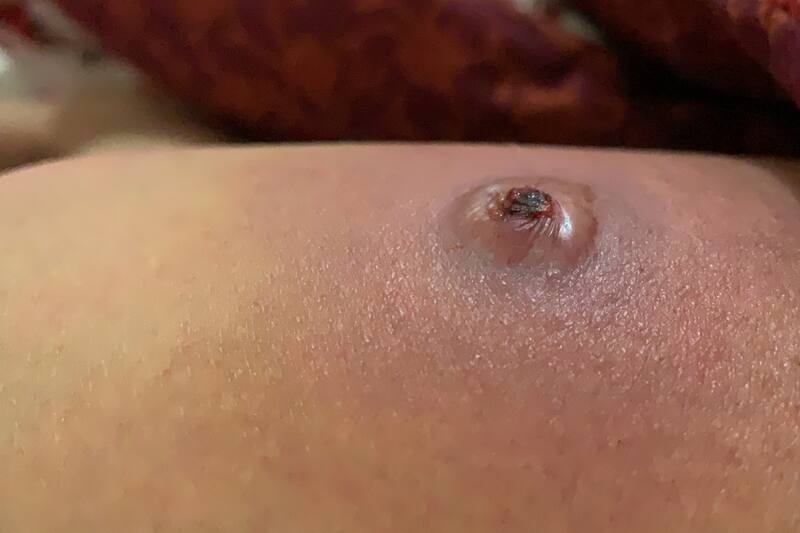 Revisa que aconseja la Clínica Alemana.