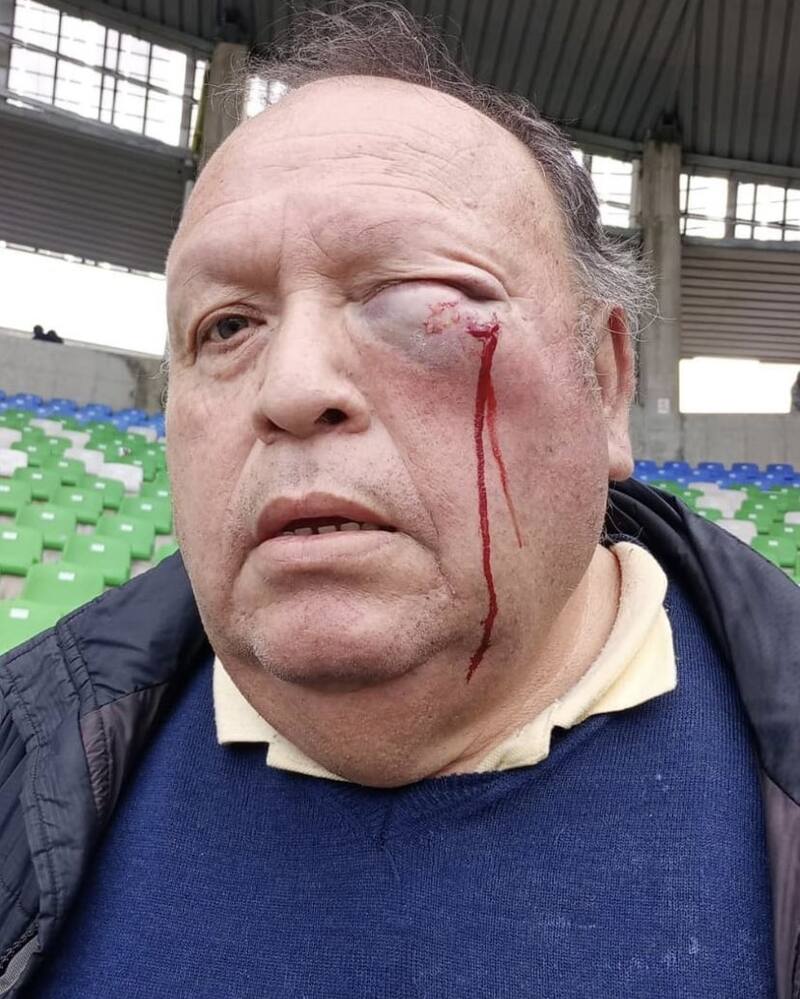 Así quedó el hincha agredido por Mauricio Viana.