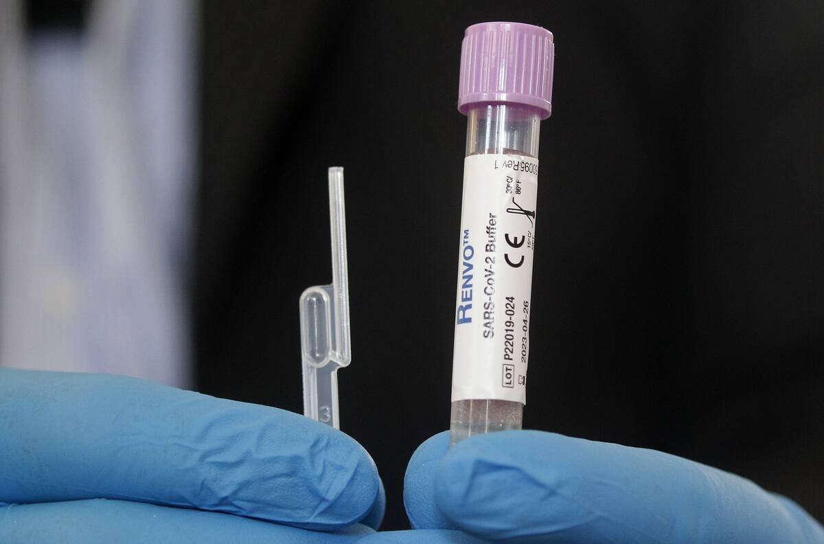 Balance Covid-19: ¿Cuántos casos nuevos y fallecidos por coronavirus reportó el Minsal este jueves 8 de septiembre?
