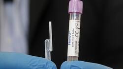 Balance Covid-19: ¿Cuántos casos nuevos y fallecidos por coronavirus reportó el Minsal este jueves 8 de septiembre?