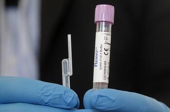 Balance Covid-19: ¿Cuántos casos nuevos y fallecidos por coronavirus reportó el Minsal este jueves 8 de septiembre?