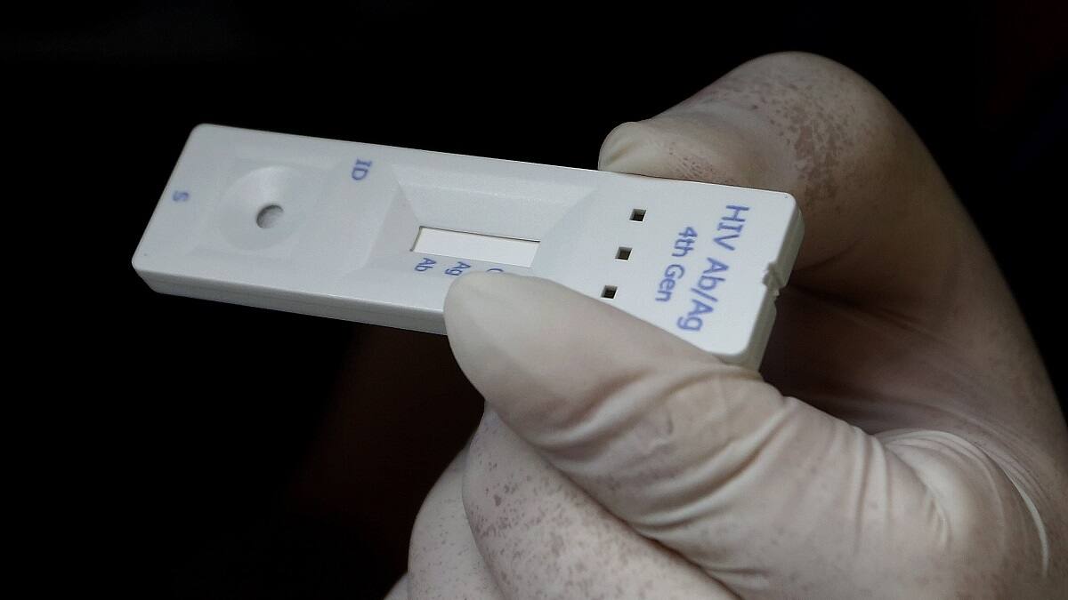 Científicos descubren nueva variante del VIH más agresiva y contagiosa: ¿Qué se sabe hasta ahora?