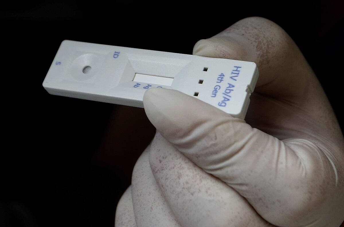 Científicos descubren nueva variante del VIH más agresiva y contagiosa: ¿Qué se sabe hasta ahora?