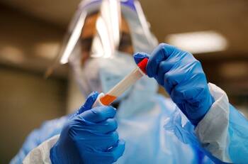 Balance coronavirus: hubo una leve baja en los casos y la positividad sigue en un 4% en la RM