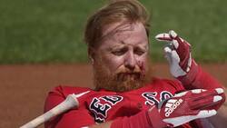 VIDEO | Justin Turner recibe pelotazo en el rostro durante un partido de pretemporada