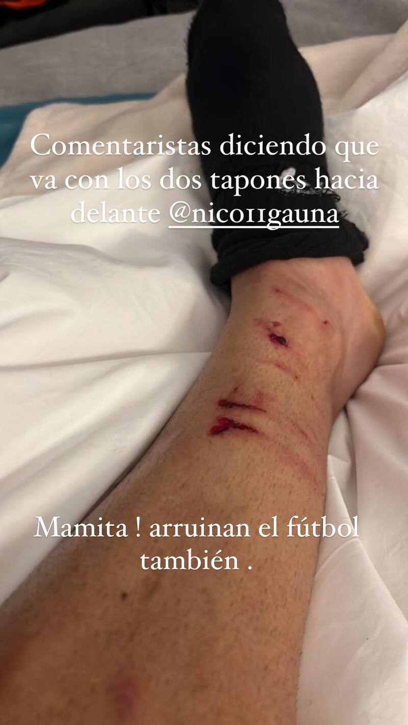 Así quedó la pierna de Nicolás Gauna tras ser expulsado.