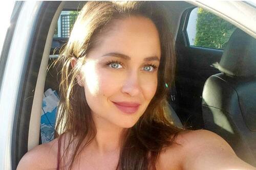 Francini Amaral evidenció el retoque estético en el rostro al que se sometió