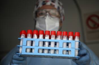 Balance Covid-19: ¿Cuántos nuevos casos positivos y fallecidos hubo este viernes 26 de agosto?