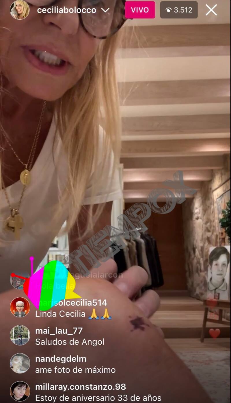 Cecilia Bolocco muestra la herida de su rodilla / Créditos: Instagram