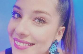 "En una hora estaré bien": María José Quintanilla preocupó a sus seguidores de redes sociales por una alergia