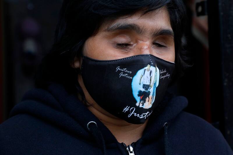 San Bernardo, 28 de agosto de 2020.
Fabiola Campillai es fotografiada en su domicilio durante la jornada en que un excarabinero fue detenido por su supuesta participacion en el impacto con una bomba lacrimogena ocurrido el pasado 26 de noviembre que le costo la vision y otras secuelas fisicas y sicologicas.
Andres Pina/Aton Chile