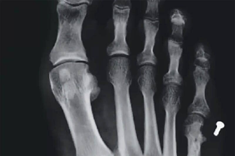 Esta es una de las radiografías. Créditos: LUN.