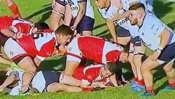 Video | Mal compañero: La escalofriante lesión que le propinó un jugador de rugby a un rival en Argentina
