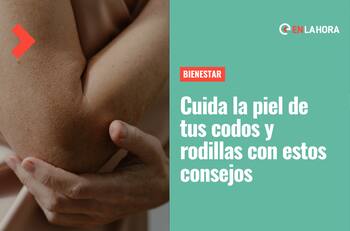 ¿Sufres de resequedad en codos y rodillas? Estos consejos te ayudarán a mantener tu piel perfecta