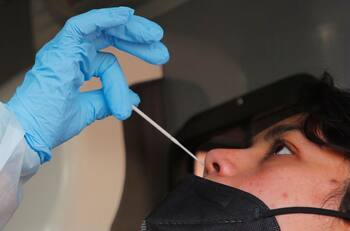 Informe Covid-19: ¿Cuántos contagios nuevos se reportaron en Chile este sábado 30 de julio?