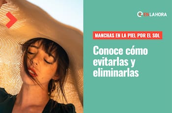 Conoce cómo eliminar las manchas producidas por el sol en la cara