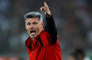 Los errores del Superclásico que Fernando Ortiz no quiere repetir contra Audax Italiano