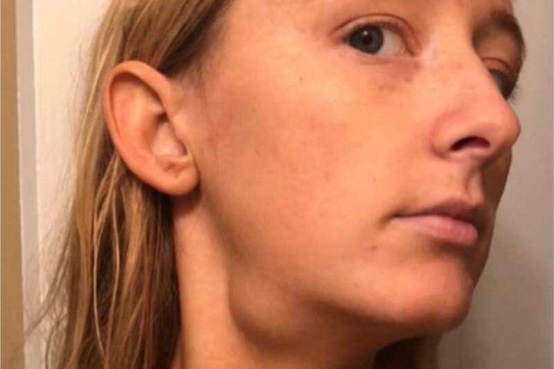 Mujer detecta cáncer gracias a rutina de belleza.