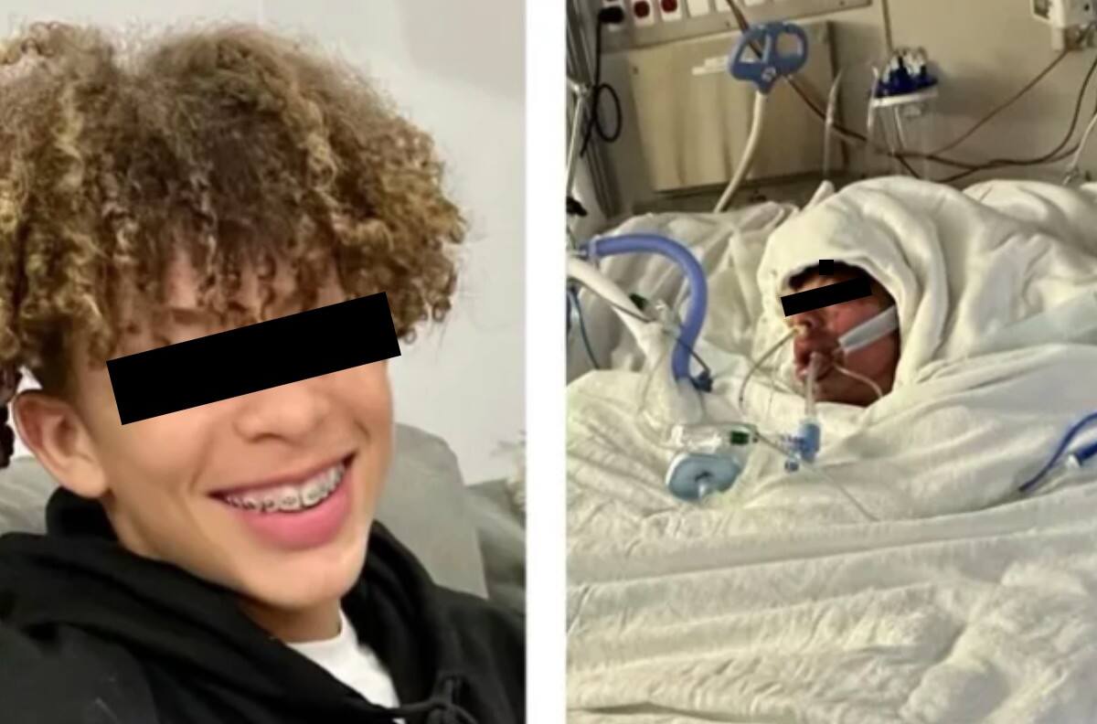 Joven termina desfigurado y con el 75% del cuerpo quemado por reto de TikTok