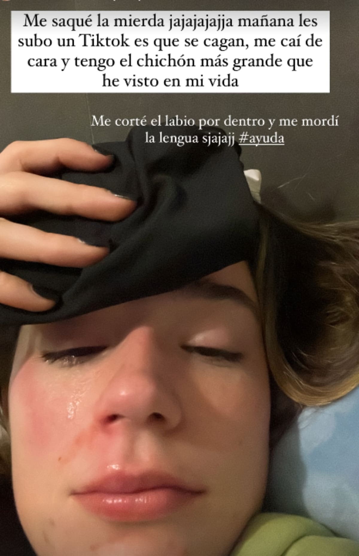 Alessia Traverso se lesionó en su casa y mostró el video en redes sociales.