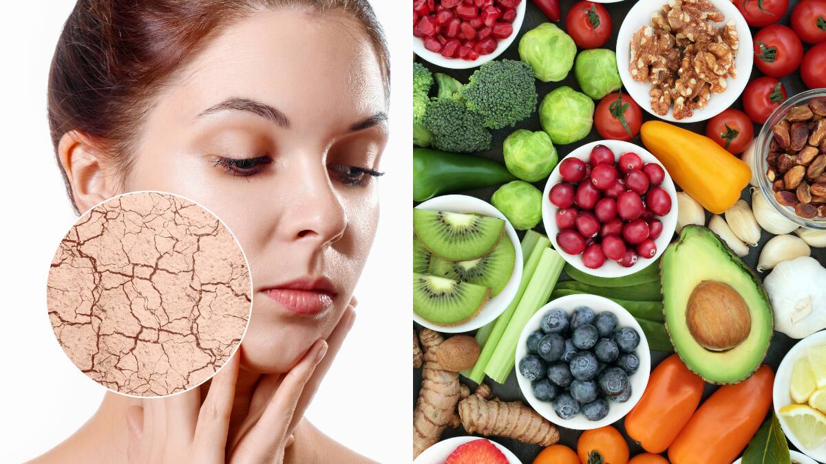 Estos son los alimentos que debes consumir para mantener una piel sana e hidratada