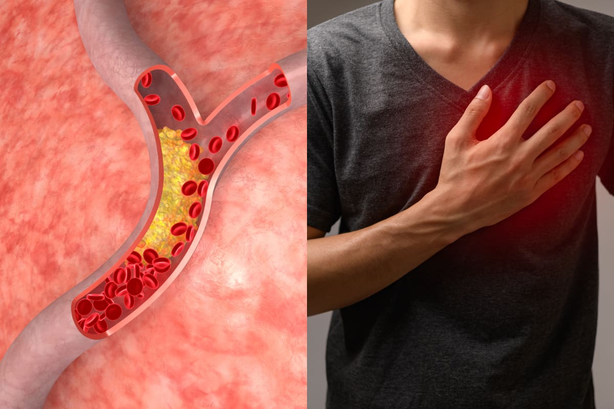 Revise los alimentos recomendados por Harvard.