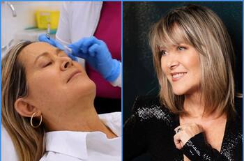 Andrea Tessa impacta tras realizarse novedoso procedimiento para rejuvenecer