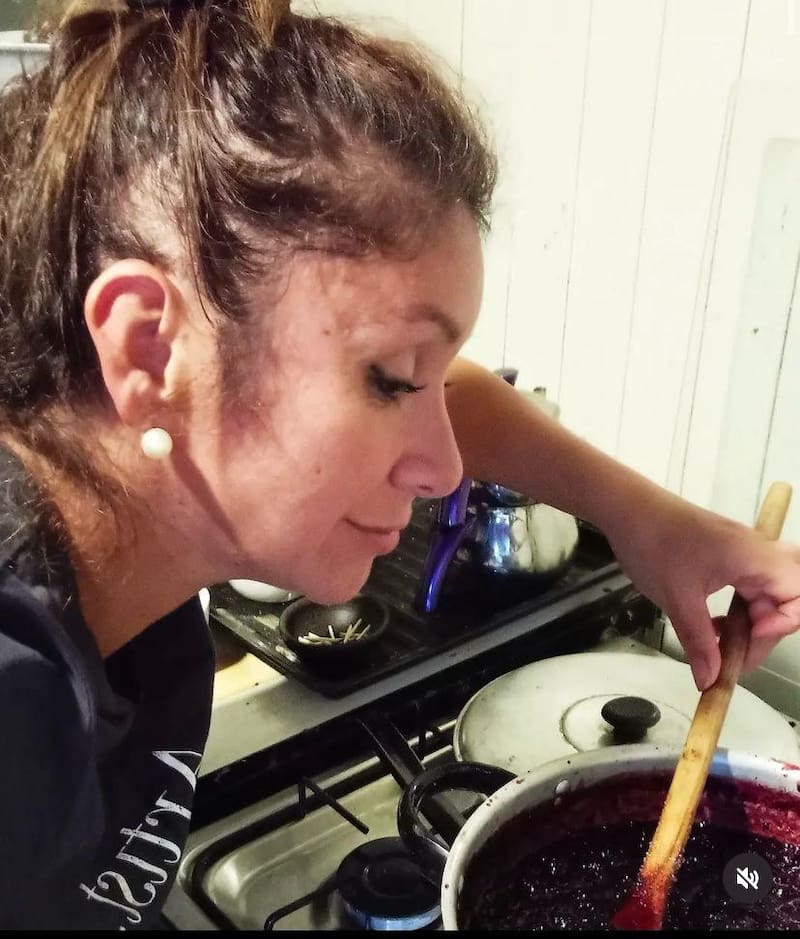 Angélica Sepúlveda muestra las consecuencias de su alopecia.
