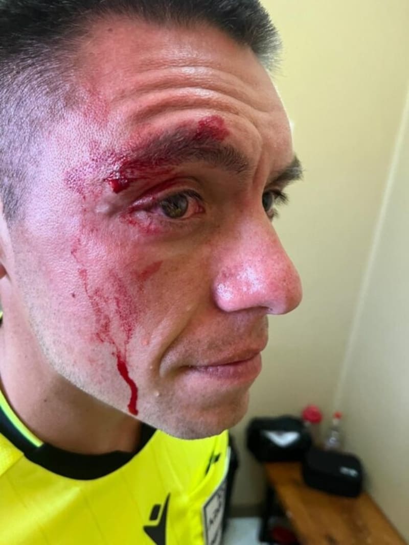 Árbitro de Tercera A fue brutalmente agredido.