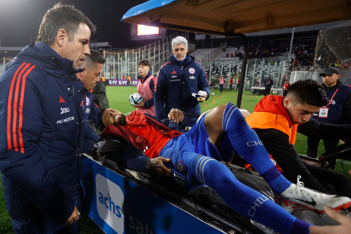 se lesionó de gravedad jugando por la selección chilena (Foto: Aton)