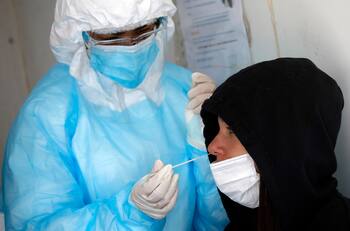 Balance Covid-19: ¿Cuántos casos registró el Minsal este sábado 29 de abril?