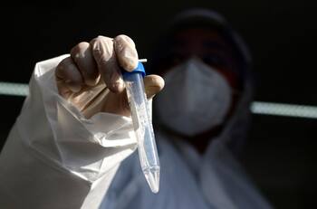 Balance Minsal: Conoce los casos registrados este viernes 28 de abril