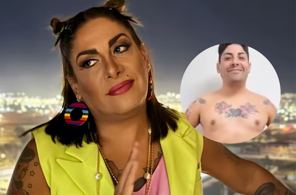 El impactante antes y después de Botota Fox tras someterse a radical cirugía estética