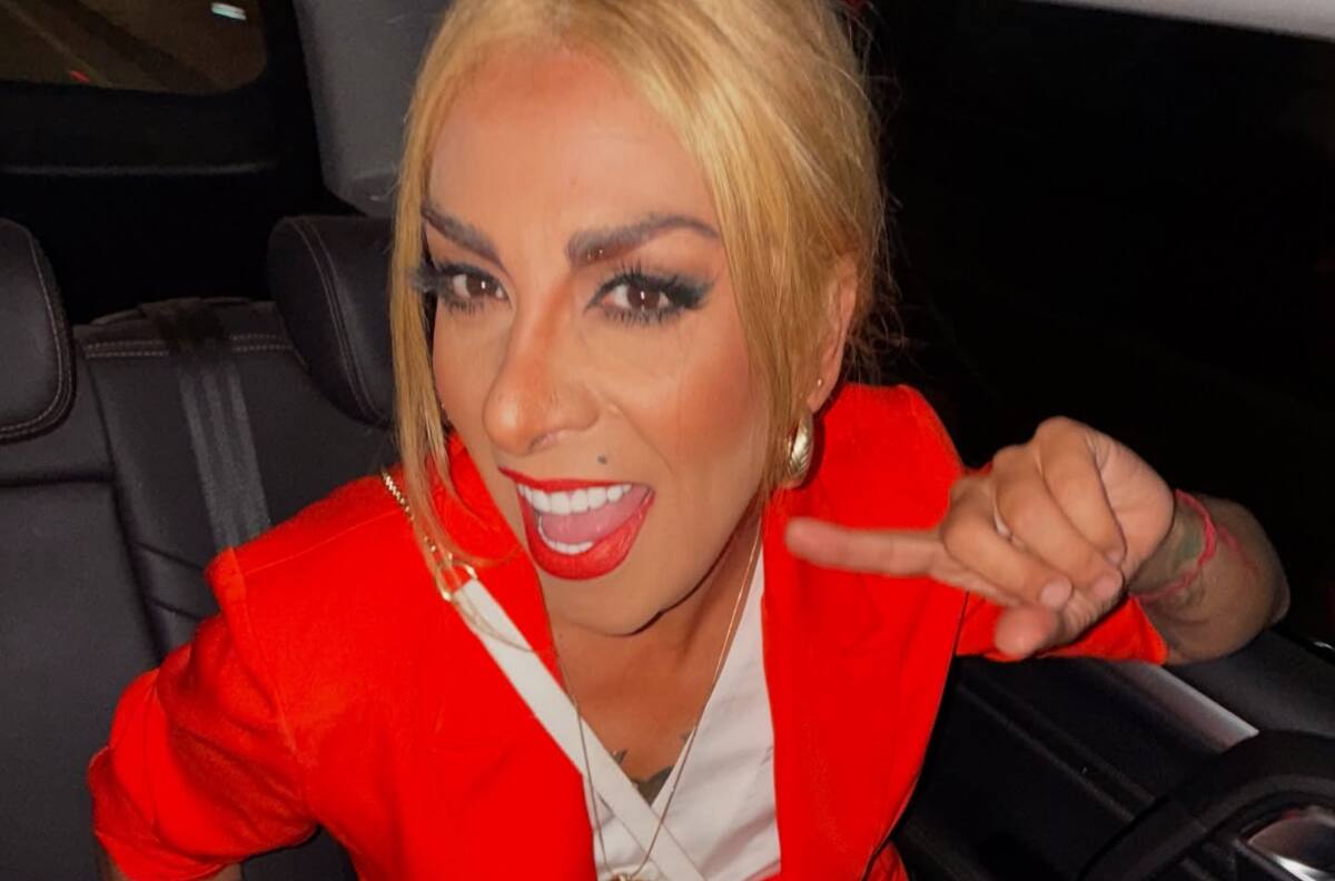 ¿En qué consiste el impactante procedimiento estético que se hizo Botota Fox y cómo quedó?