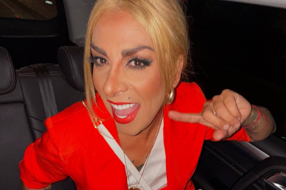 La comediante pasó por el quirófano recientemente.