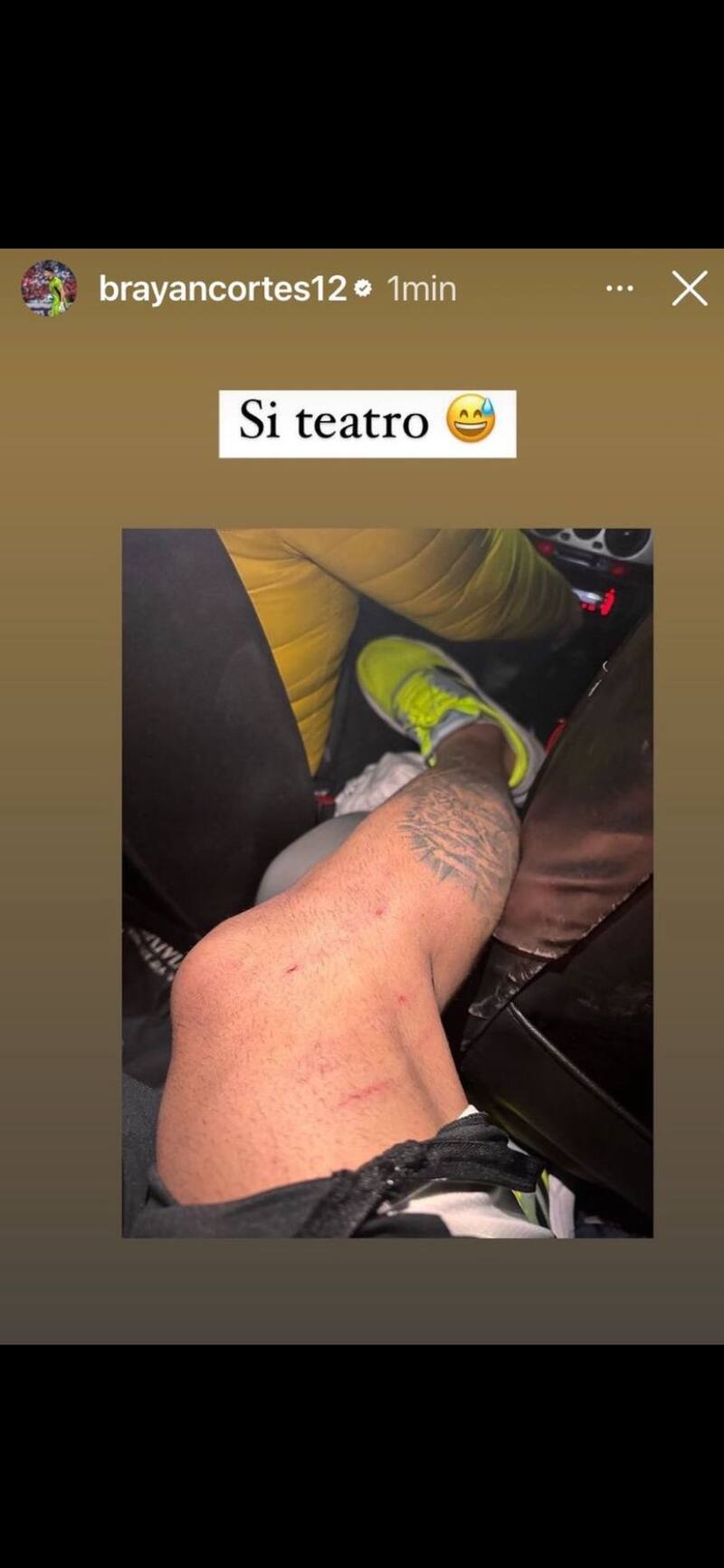 Brayan Cortés mostrando las heridas que le quedaron en su pierna tras la polémica jugada con Cristian Insaurralde