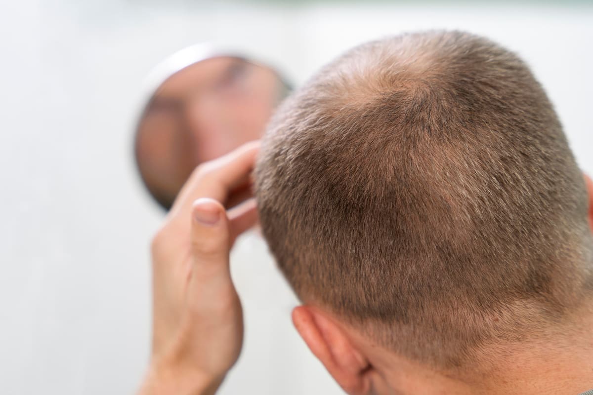Entérate qué cambios debes hacer en tu dieta para evitar la caída del cabello.