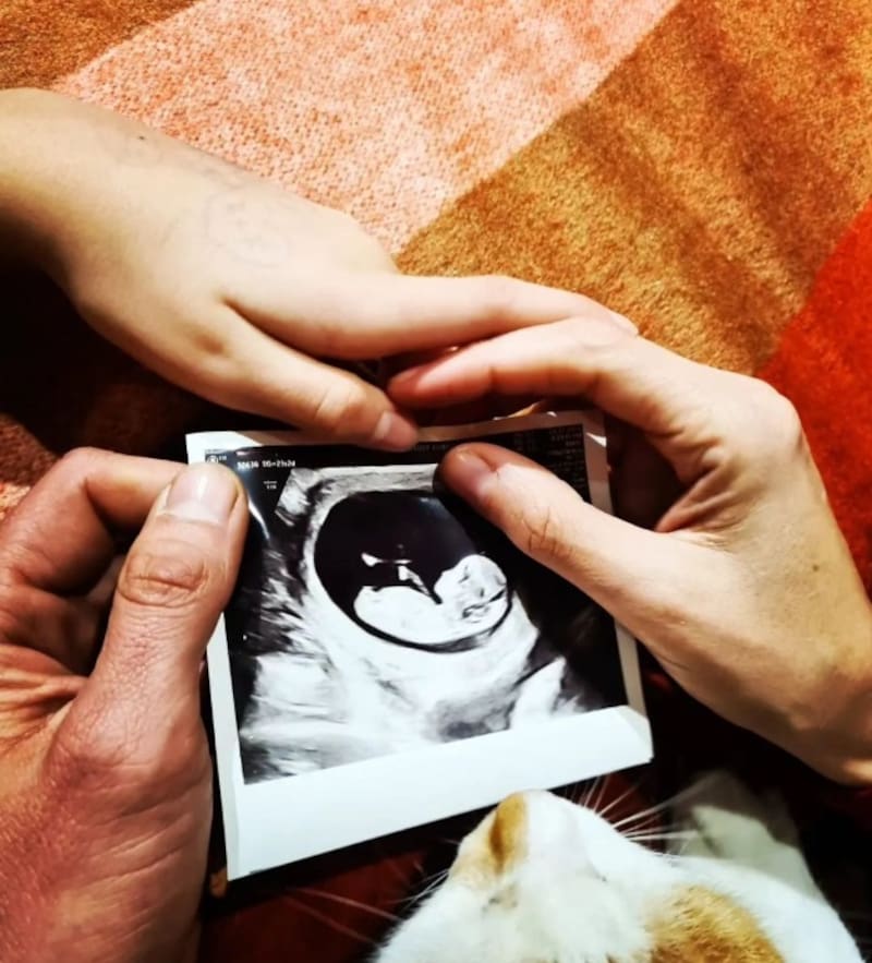 Camila Vallejo y Abel Zicavo esperan a su primer hijo. Créditos: Instagram