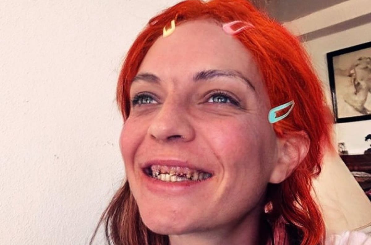Madre de Sheila Devil es atacada por un perro, tras acalorada discusión en la que fuera la casa de Camilo Sesto