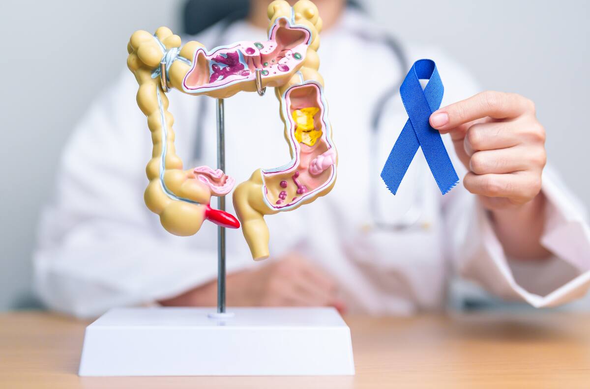 Cáncer de colon: consejos de Harvard sobre exámenes preventivos y personas de riesgo