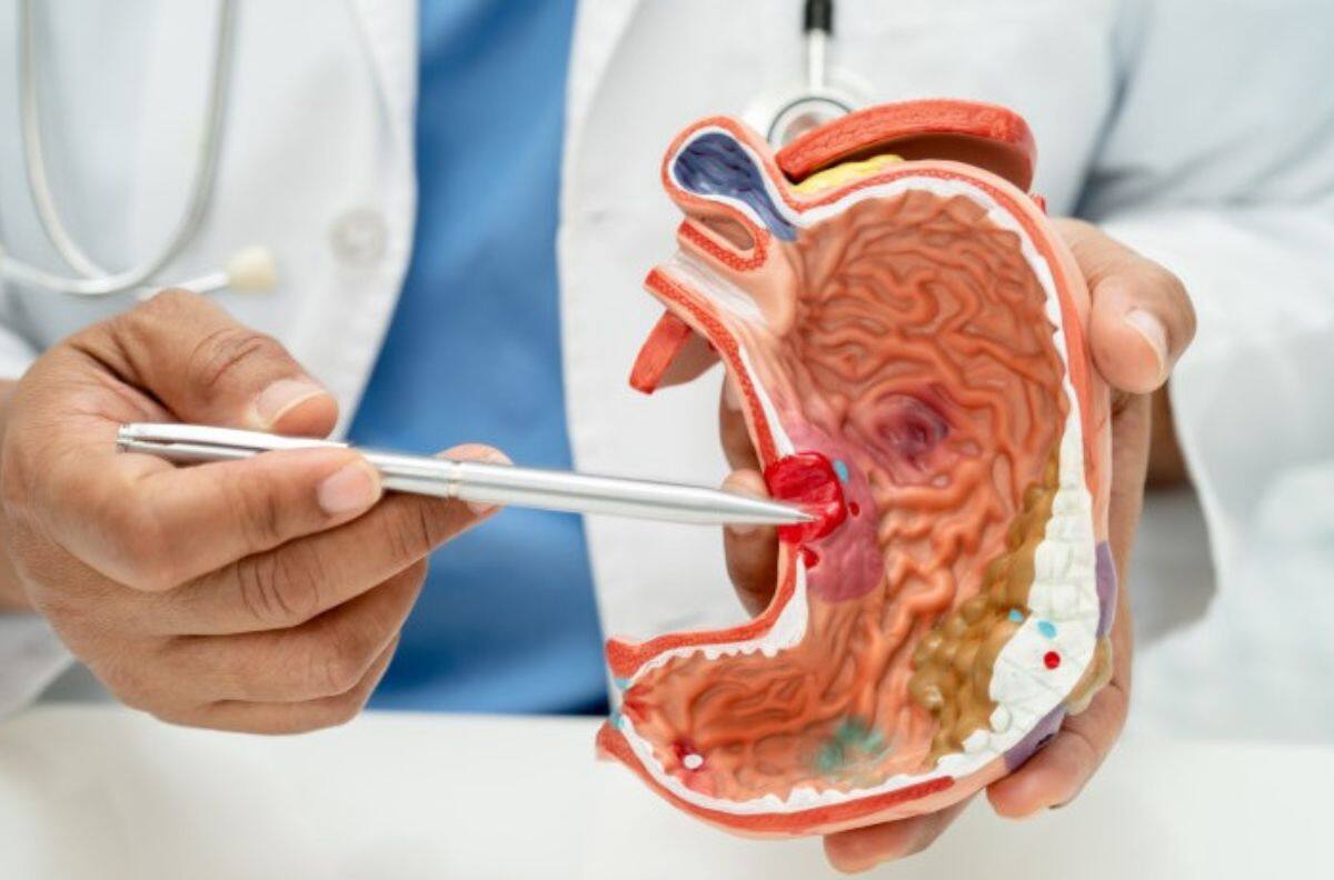 Doctora chilena desarrolló importante probiótico capaz de prevenir el cáncer gástrico